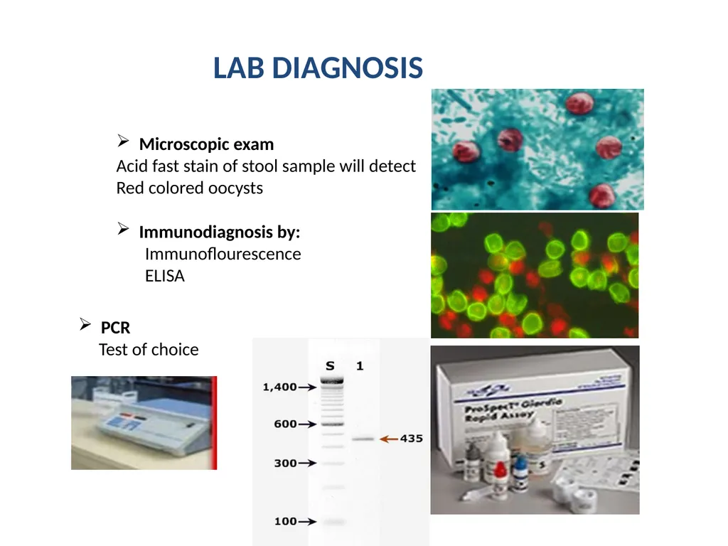 Cryptosporidium & Cryptosporidiosis - slide 15 of 16