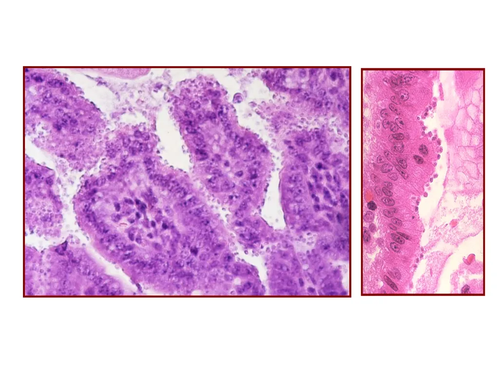 Cryptosporidium & Cryptosporidiosis - slide 7 of 16