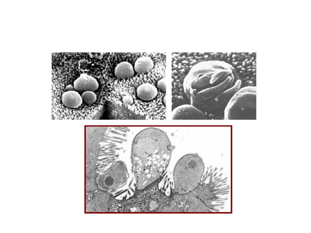 Cryptosporidium & Cryptosporidiosis - slide 8 of 16