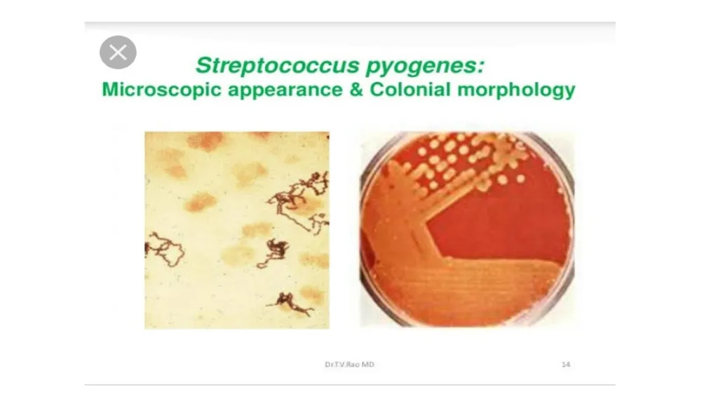 PATHOGENIC MICROORGANISMS WHAT IS A PATHOGEN? A - slide 20 of 38