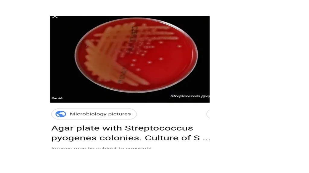 PATHOGENIC MICROORGANISMS WHAT IS A PATHOGEN? A - slide 21 of 38