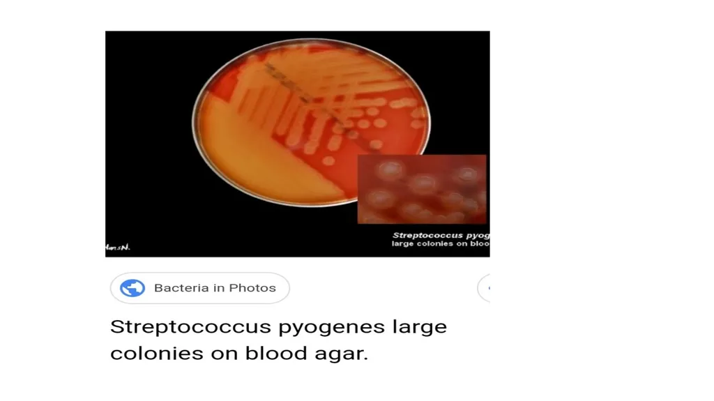 PATHOGENIC MICROORGANISMS WHAT IS A PATHOGEN? A - slide 22 of 38