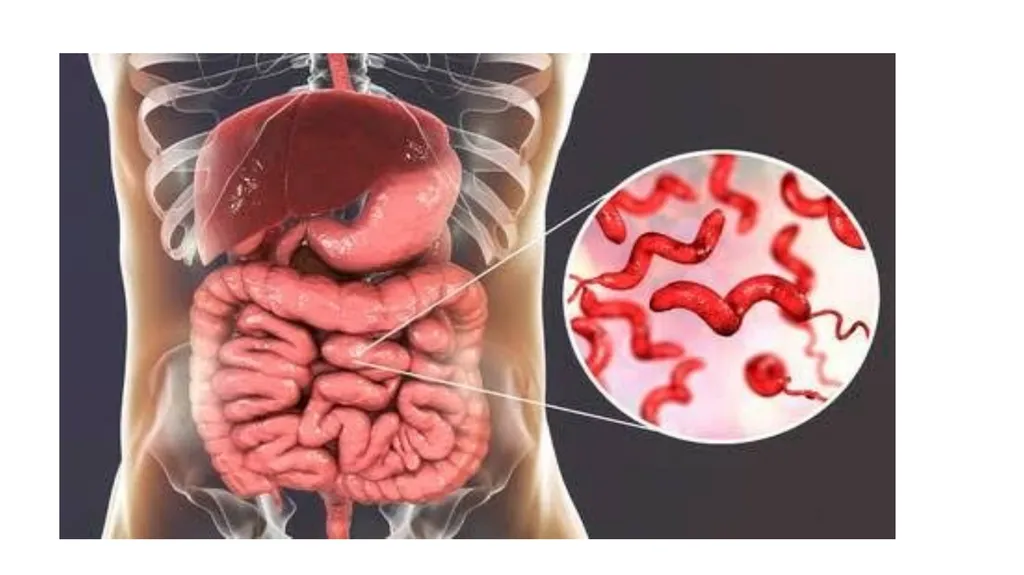 PATHOGENIC MICROORGANISMS WHAT IS A PATHOGEN? A - slide 26 of 38
