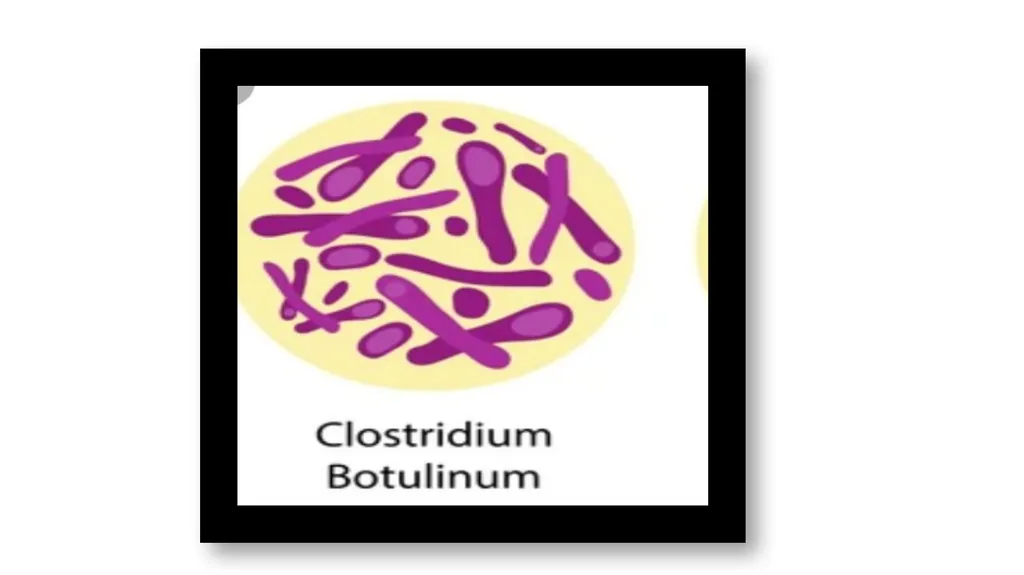 PATHOGENIC MICROORGANISMS WHAT IS A PATHOGEN? A - slide 35 of 38