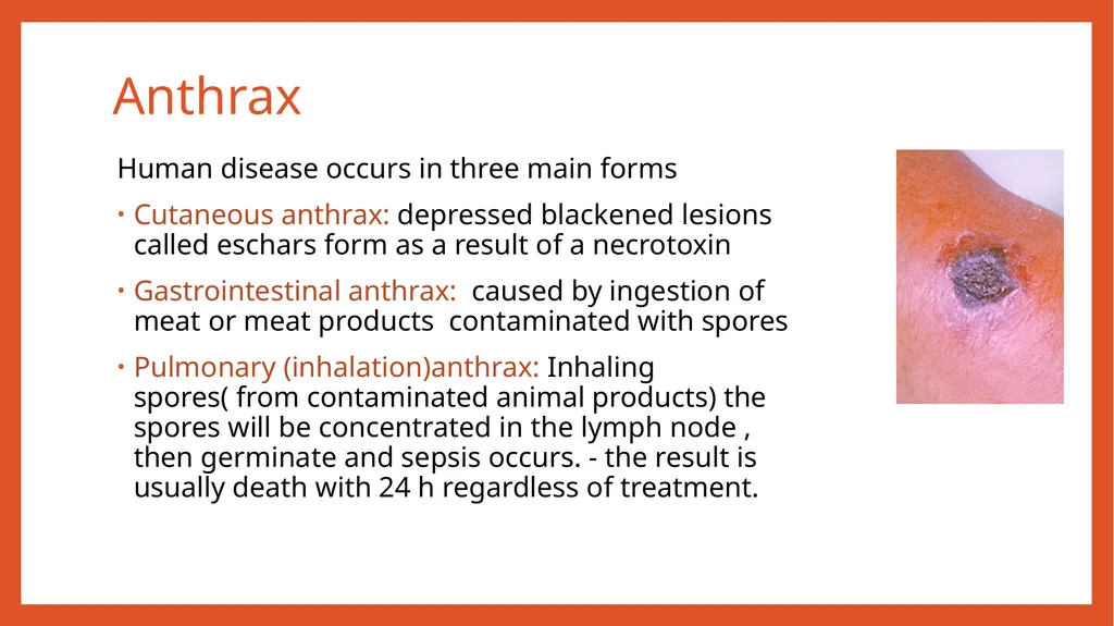 Zoonotic infections CLS 416 Learning outcomes - slide 14 of 40