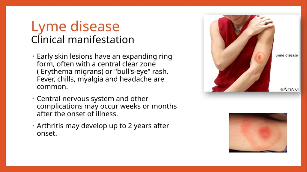 Zoonotic infections CLS 416 Learning outcomes - slide 28 of 40