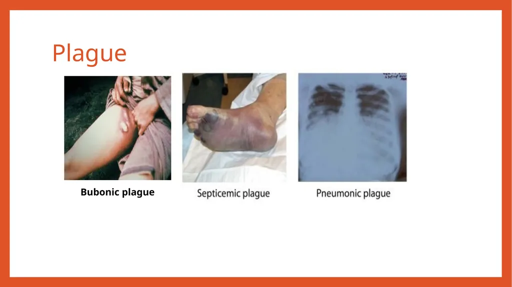 Zoonotic infections CLS 416 Learning outcomes - slide 31 of 40