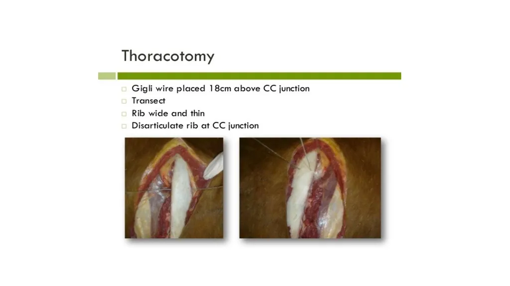UNIT-5 (REGIONAL SURGERY-II) UG COURSES DR. - slide 5 of 26