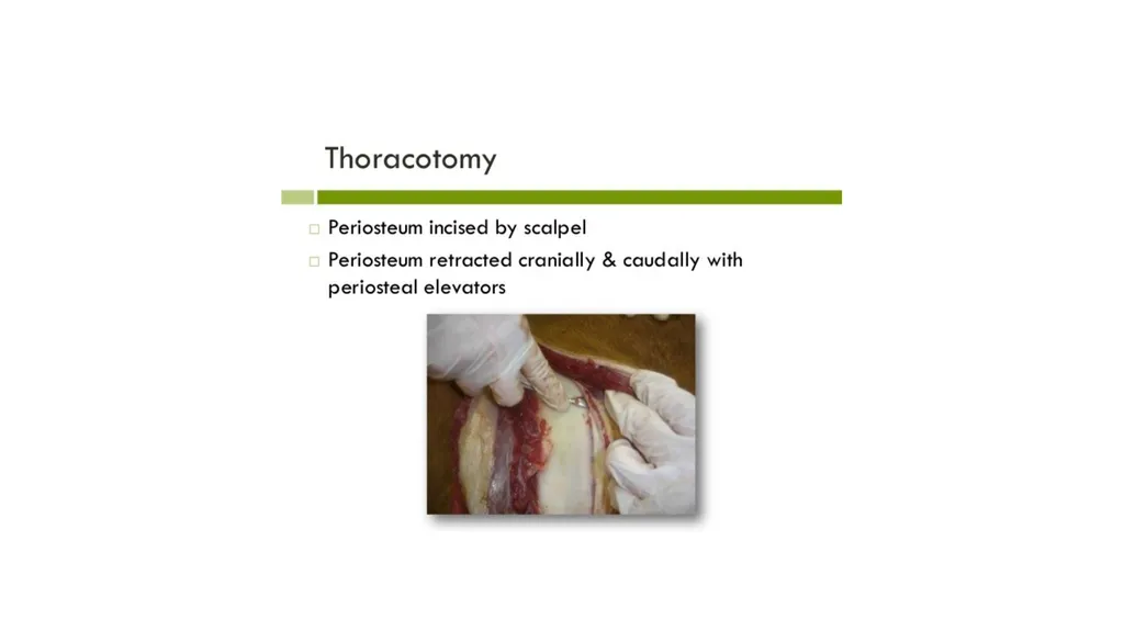 UNIT-5 (REGIONAL SURGERY-II) UG COURSES DR. - slide 8 of 26