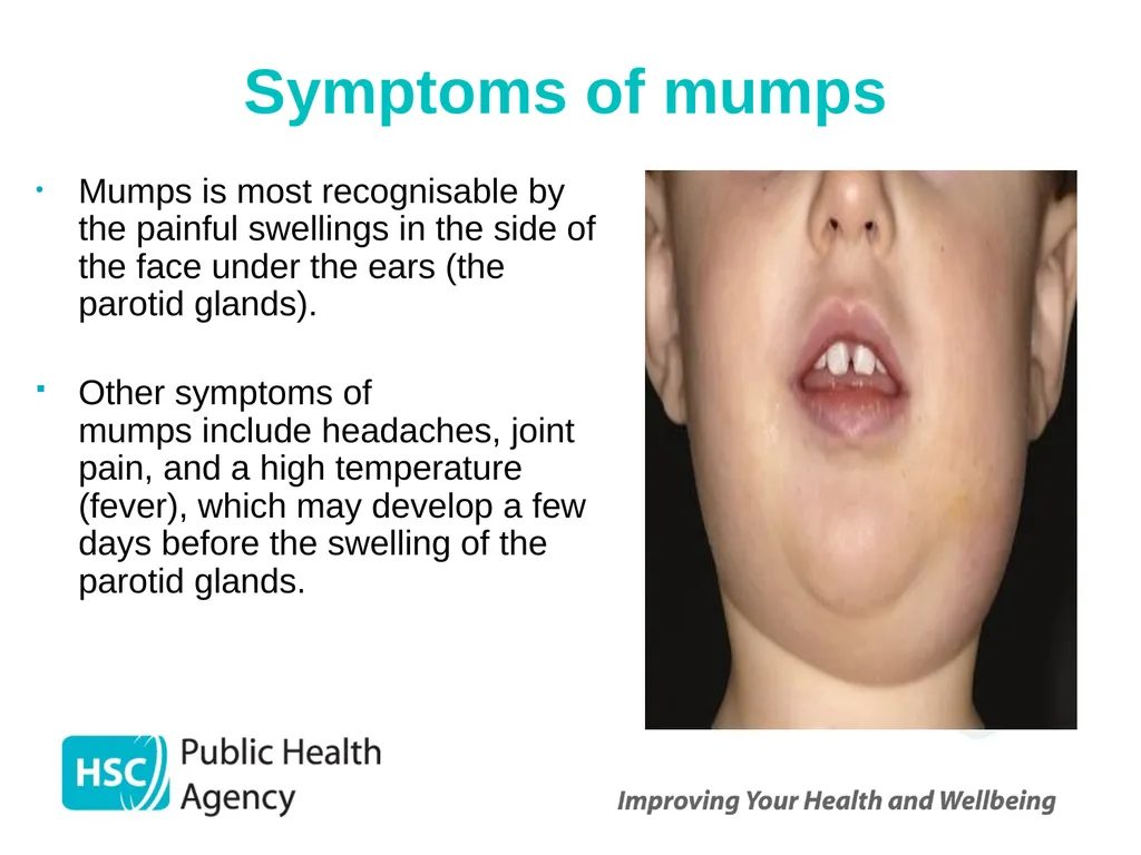 Measles, mumps and rubella Prepared by the PHA - slide 17 of 49