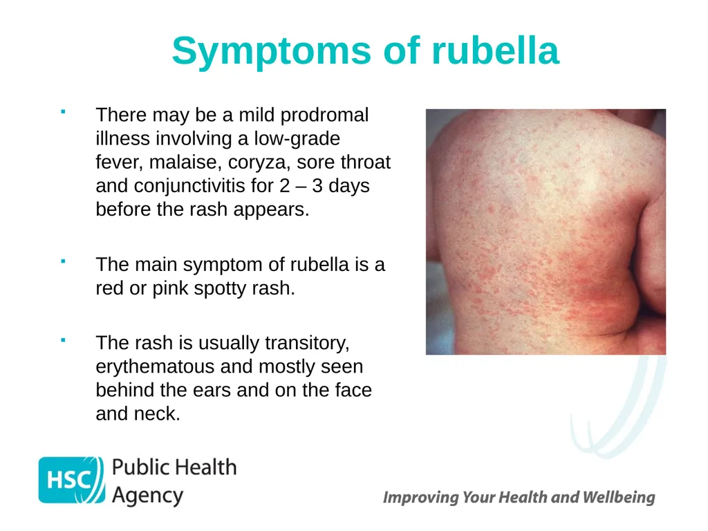 Measles, mumps and rubella Prepared by the PHA - slide 24 of 49