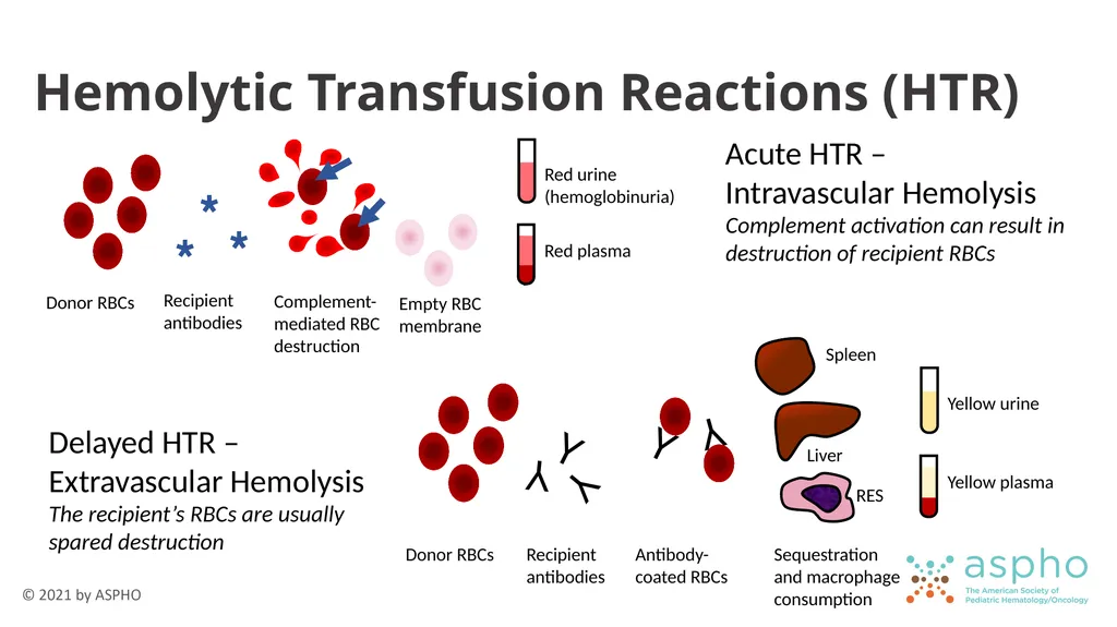 Transfusion Medicine Rachel S. Bercovitz, MD MS - slide 75 of 81