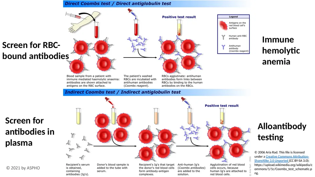 Transfusion Medicine Rachel S. Bercovitz, MD MS - slide 18 of 81