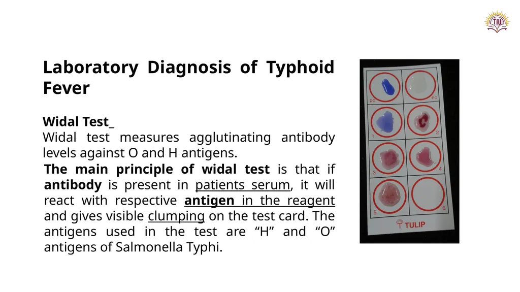 Dr. Tola FARAJ Ms. Chnar Hussam Lecturer and - slide 9 of 13
