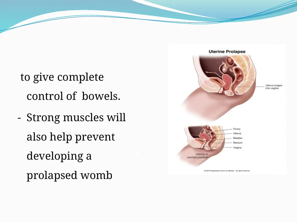 MANAGEMENT OF NORMAL PUERPERIUM Mrs. Preeti - slide 21 of 42