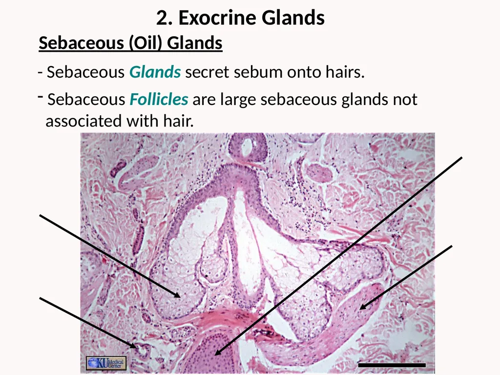 Cutaneous Membrane (Skin) Superficial Epidermis - slide 21 of 30