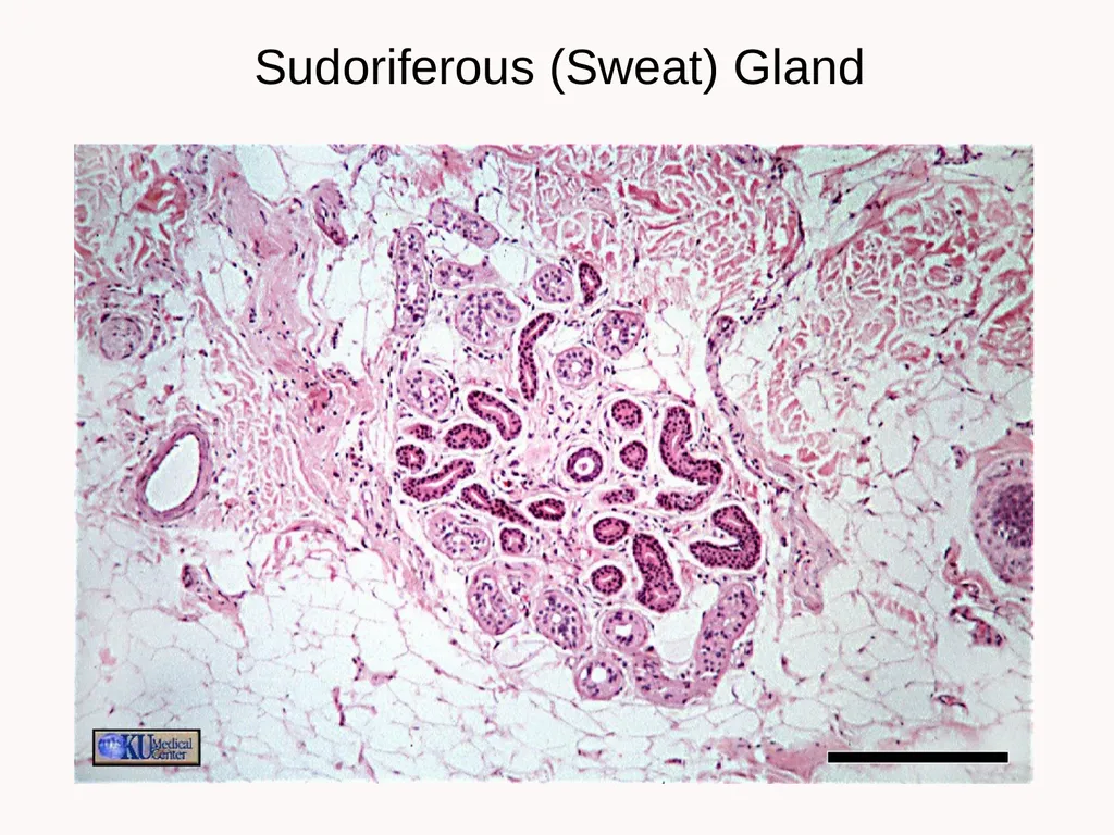 Cutaneous Membrane (Skin) Superficial Epidermis - slide 25 of 30