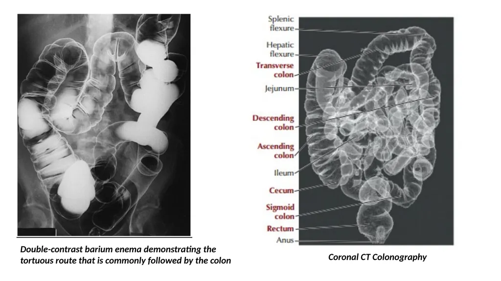 ANATOMY OF THE LOWER GASTROINTESTINAL TRACT DR. A. - slide 6 of 23