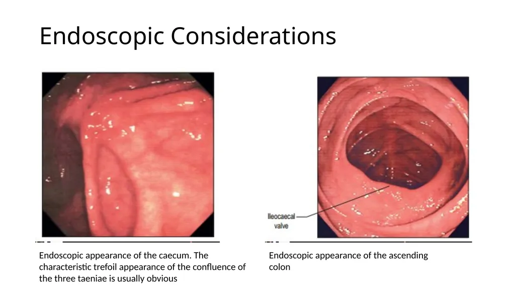 ANATOMY OF THE LOWER GASTROINTESTINAL TRACT DR. A. - slide 19 of 23