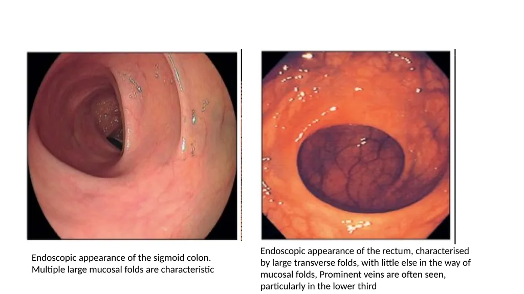 ANATOMY OF THE LOWER GASTROINTESTINAL TRACT DR. A. - slide 21 of 23