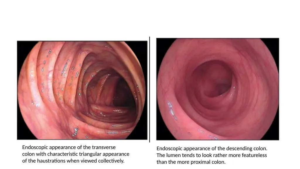 ANATOMY OF THE LOWER GASTROINTESTINAL TRACT DR. A. - slide 20 of 23