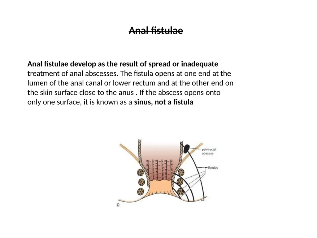 Sigmoid colon Dr. Dima Hamarsheh - slide 50 of 52