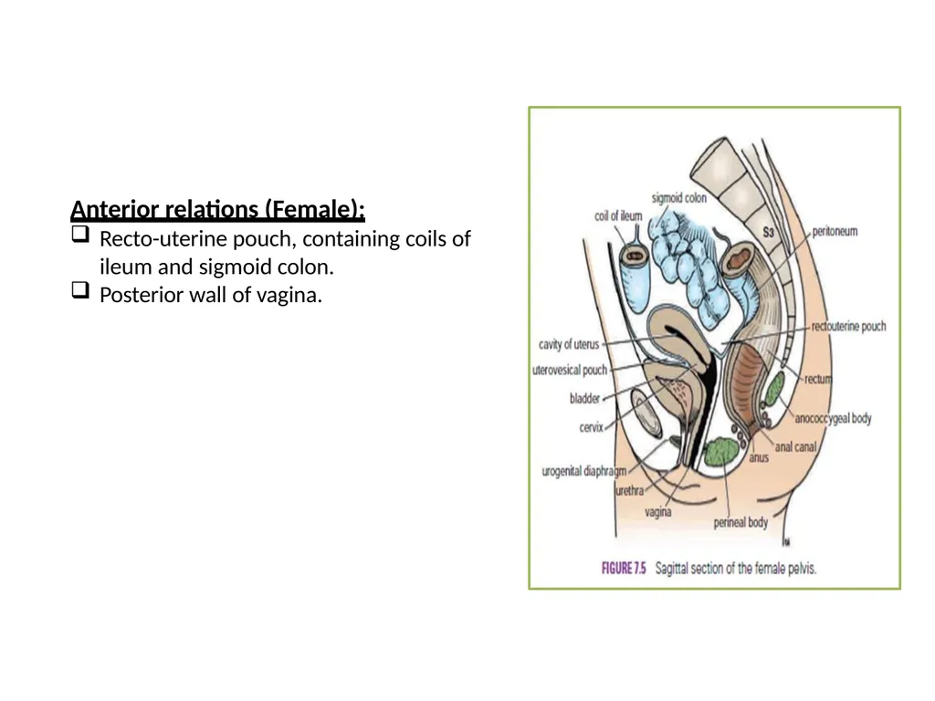 Sigmoid colon Dr. Dima Hamarsheh - slide 26 of 52