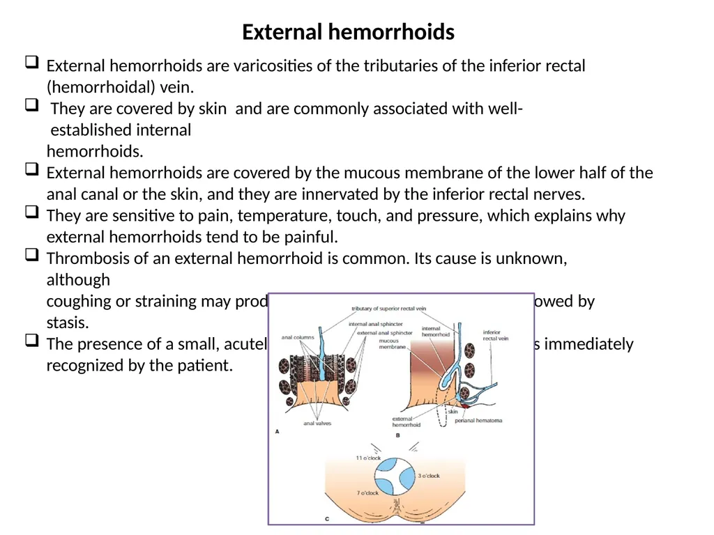 Sigmoid colon Dr. Dima Hamarsheh - slide 48 of 52