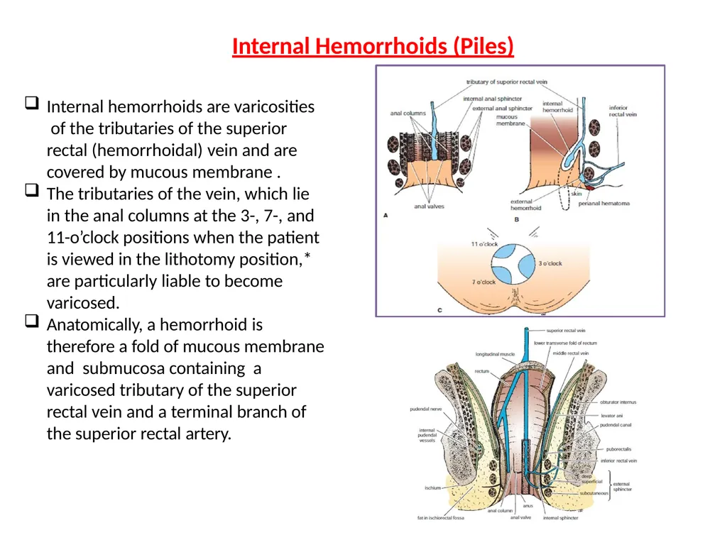 Sigmoid colon Dr. Dima Hamarsheh - slide 45 of 52