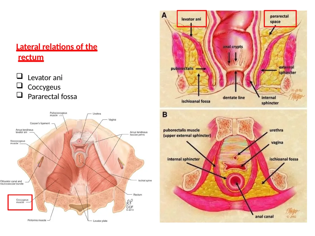 Sigmoid colon Dr. Dima Hamarsheh - slide 29 of 52