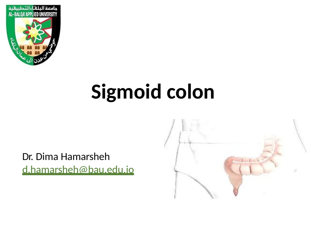 Sigmoid colon Dr. Dima Hamarsheh - slide 1 of 52
