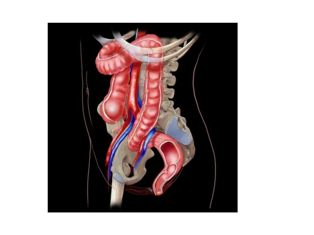Sigmoid colon Dr. Dima Hamarsheh - slide 6 of 52