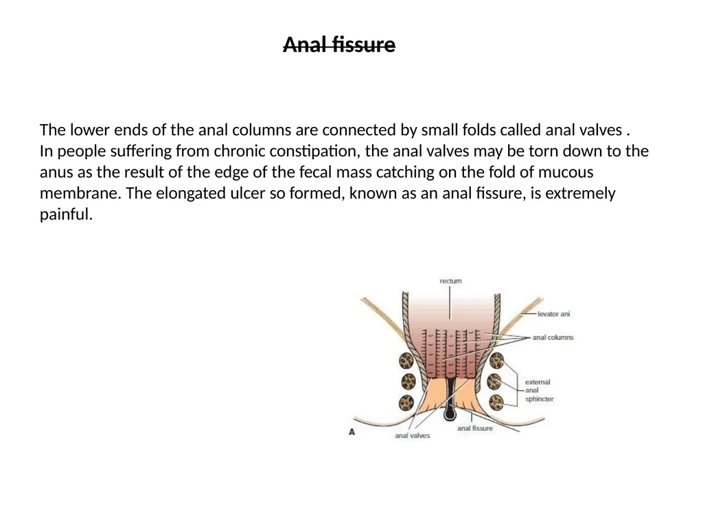 Sigmoid colon Dr. Dima Hamarsheh - slide 49 of 52