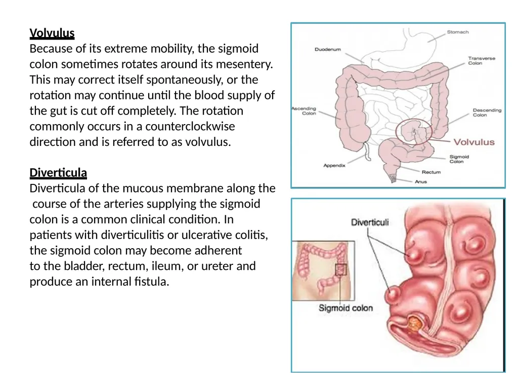 Sigmoid colon Dr. Dima Hamarsheh - slide 11 of 52