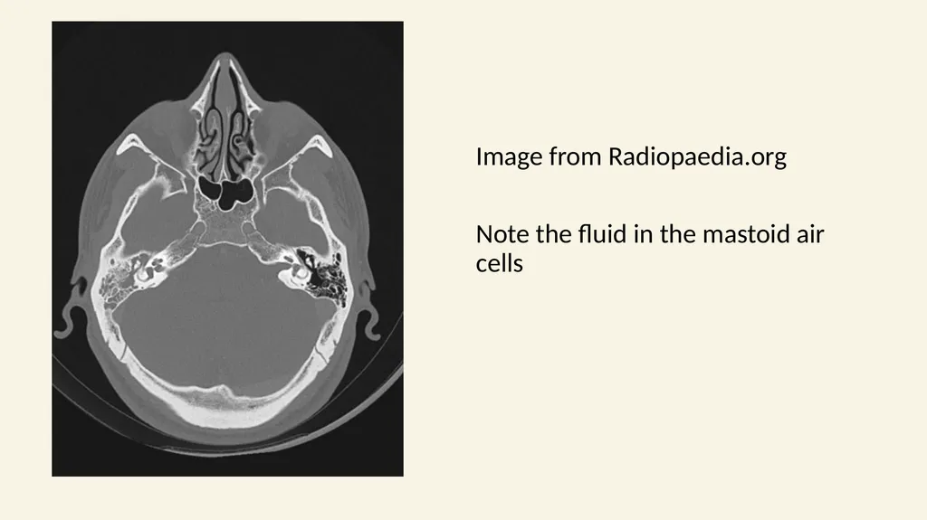 2022/2023 Revision Session Dr Dalton Barham - slide 28 of 38