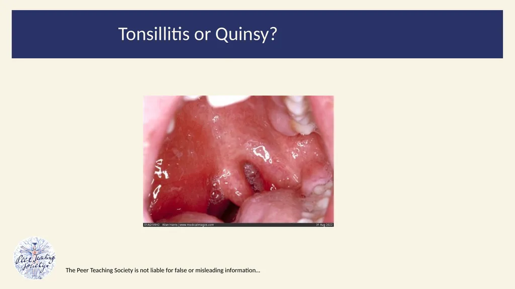 2022/2023 Revision Session Dr Dalton Barham - slide 33 of 38