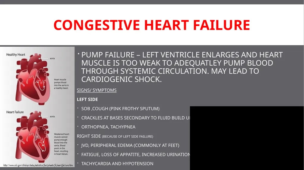 SCFD EMS CIRCULATORY EMERGENCIES Updated 03/2017 - slide 8 of 14