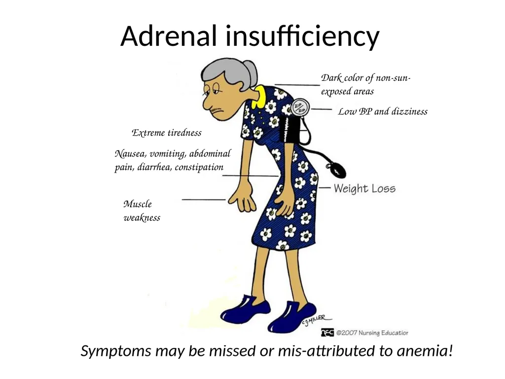 Endocrine dysfunction (Hormone imbalance) in - slide 30 of 37