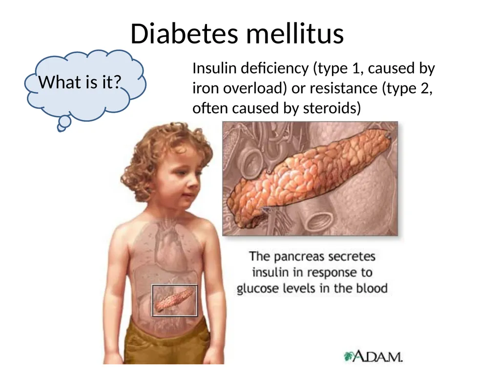 Endocrine dysfunction (Hormone imbalance) in - slide 24 of 37