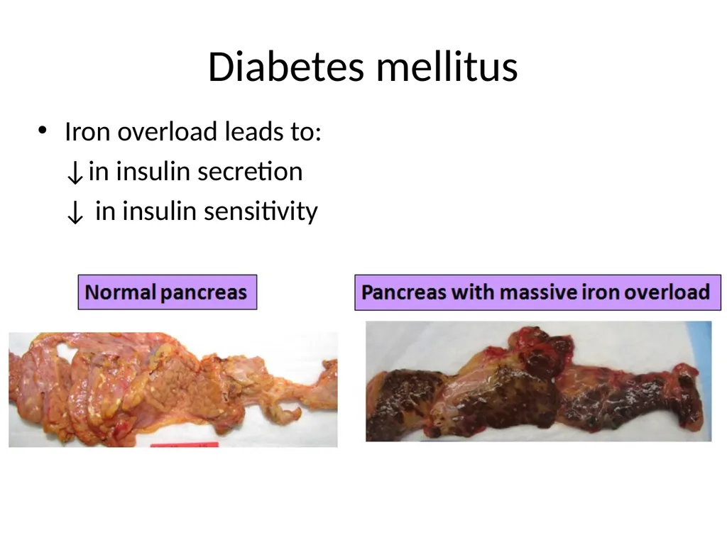 Endocrine dysfunction (Hormone imbalance) in - slide 27 of 37