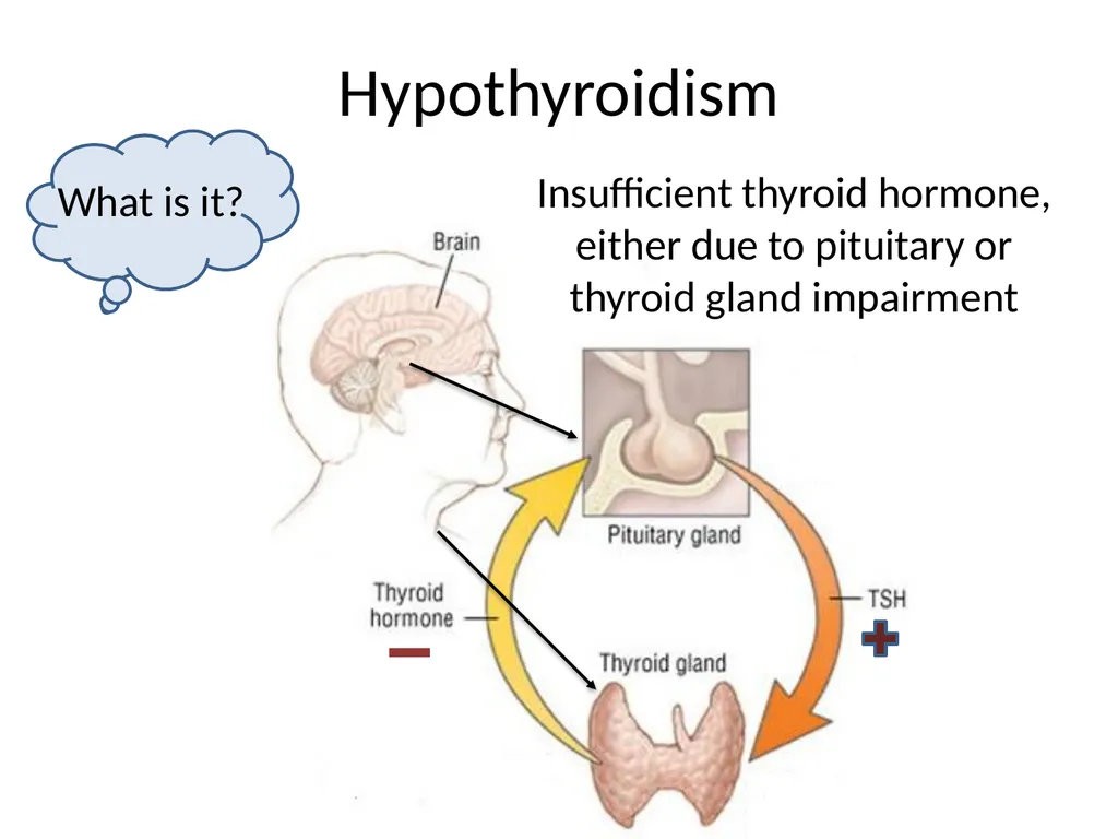 Endocrine dysfunction (Hormone imbalance) in - slide 18 of 37
