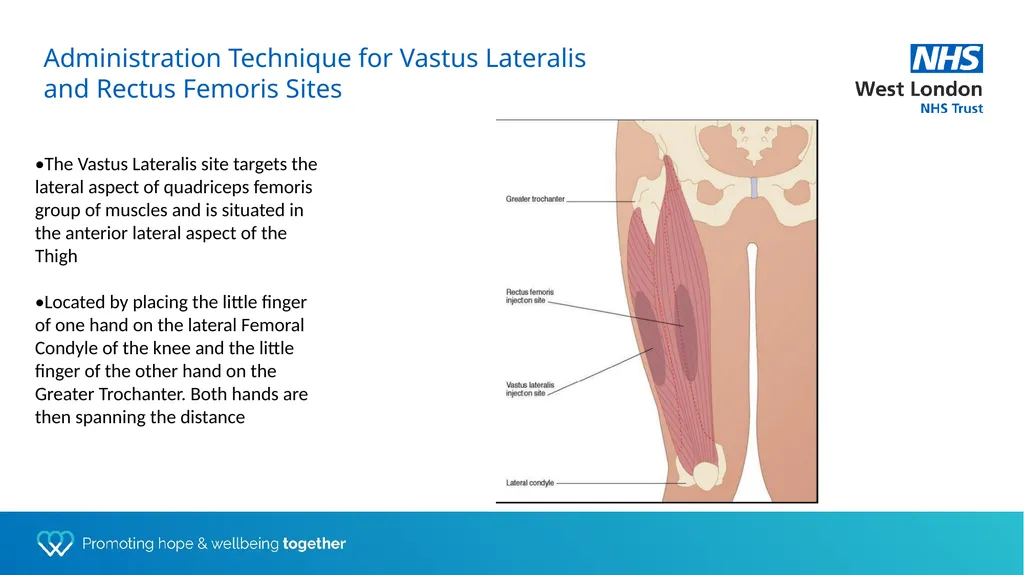 Depot training for Practice Nurses Presented by - slide 17 of 44