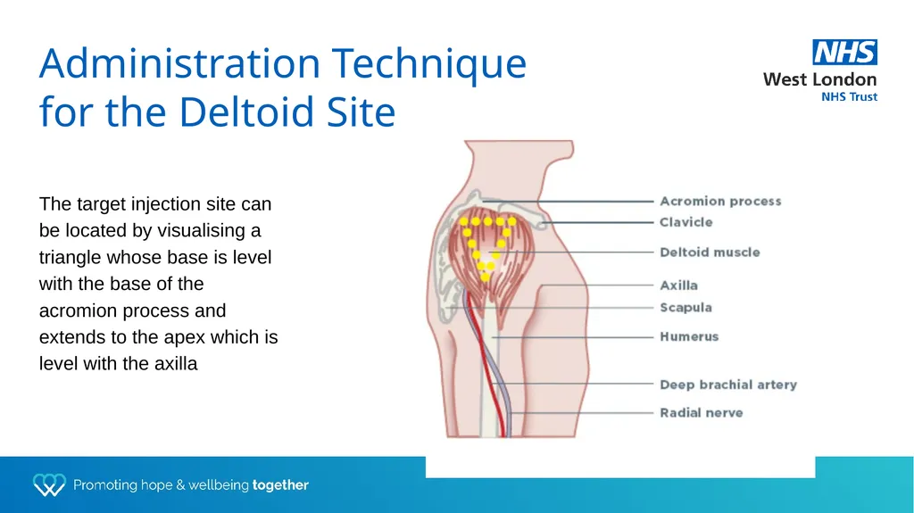 Depot training for Practice Nurses Presented by - slide 14 of 44