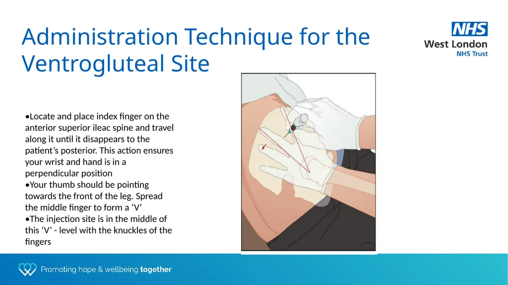 Depot training for Practice Nurses Presented by - slide 20 of 44