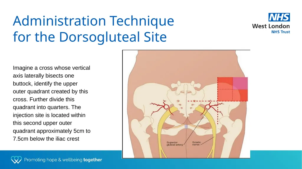 Depot training for Practice Nurses Presented by - slide 8 of 44