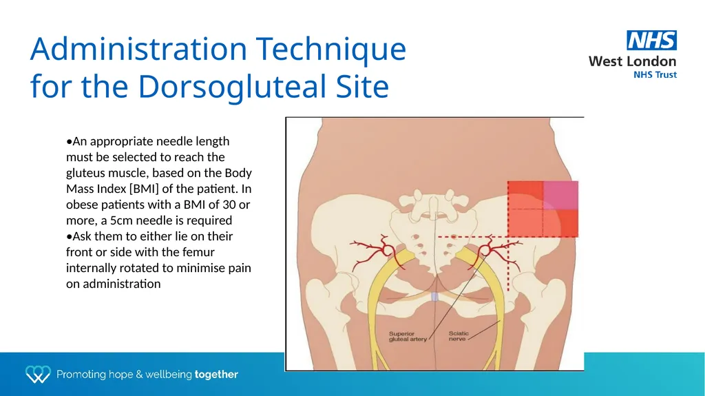 Depot training for Practice Nurses Presented by - slide 9 of 44