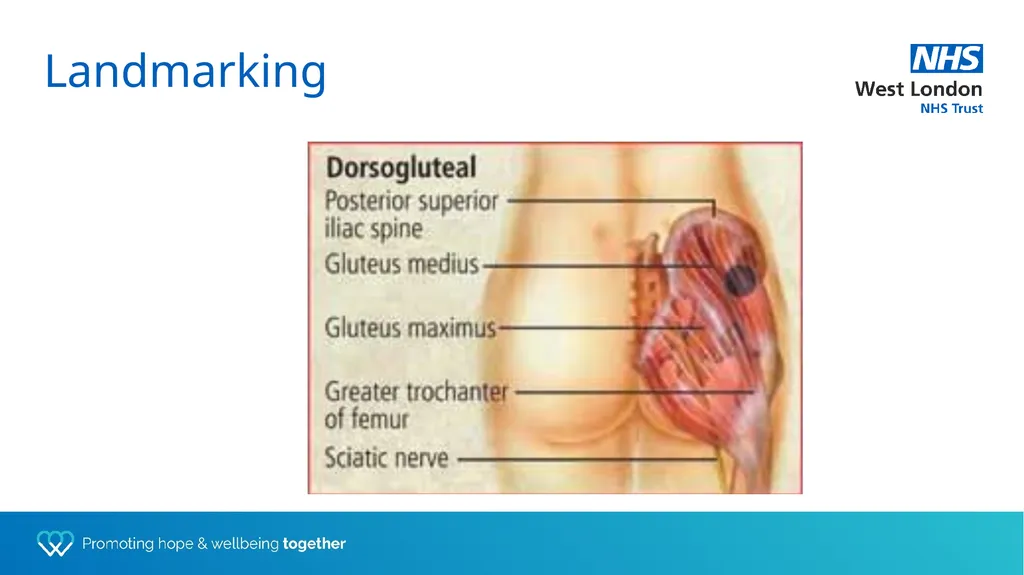Depot training for Practice Nurses Presented by - slide 10 of 44