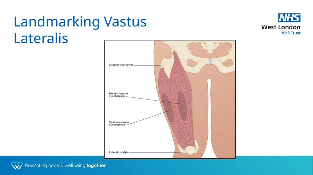 Depot training for Practice Nurses Presented by - slide 15 of 44