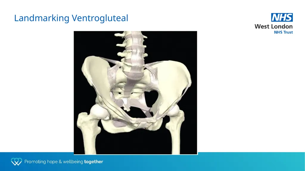 Depot training for Practice Nurses Presented by - slide 18 of 44