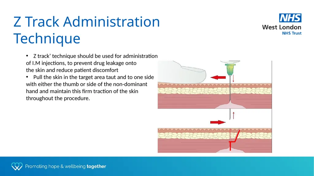 Depot training for Practice Nurses Presented by - slide 11 of 44